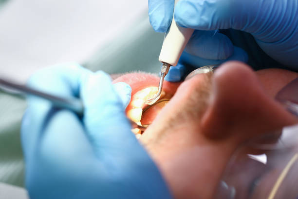 Best Emergency Care for Gum Disease in Palacios, TX