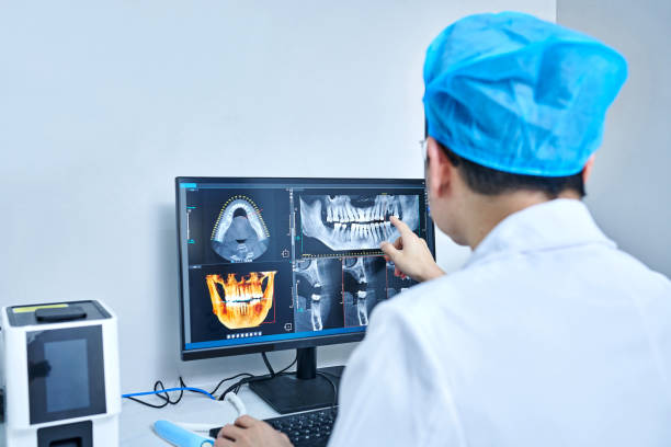 Best Emergency Wisdom Tooth Extraction in Palacios, TX