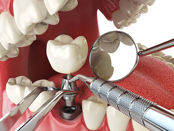 Best Emergency Root Canal Therapy in Palacios, TX